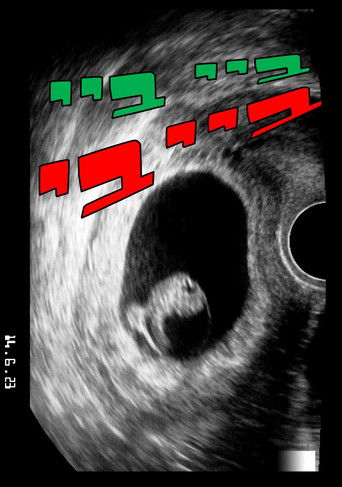 Poster for bye bye baby