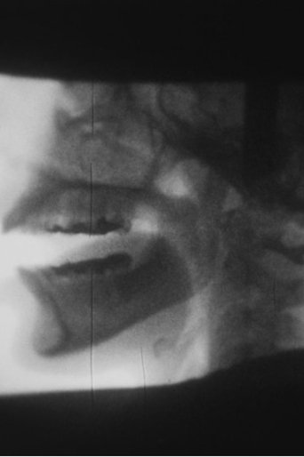 Poster for X-ray